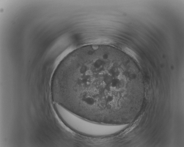 X0000062851087200601201657