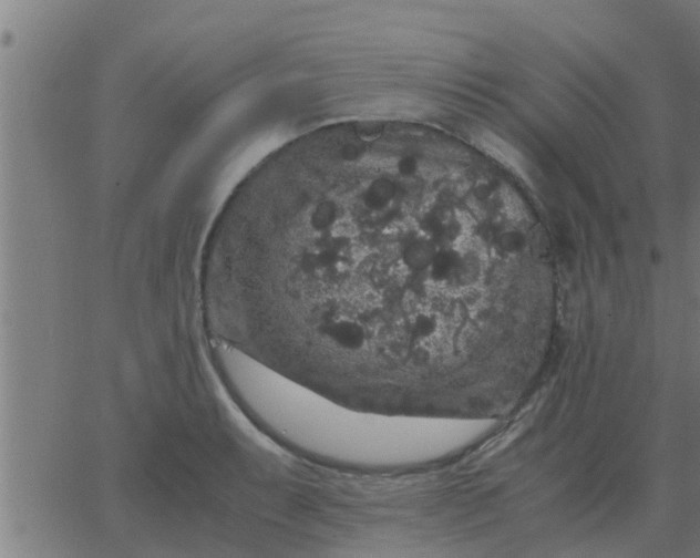 X0000062851087200601272035