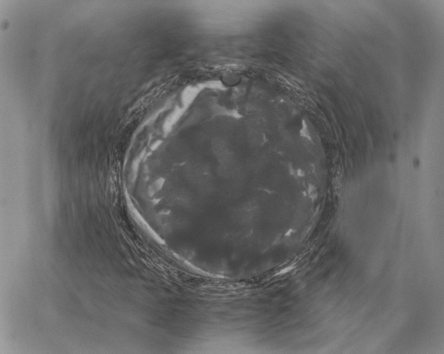 X0000062851397200602031615