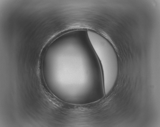 X0000062860387200601130953