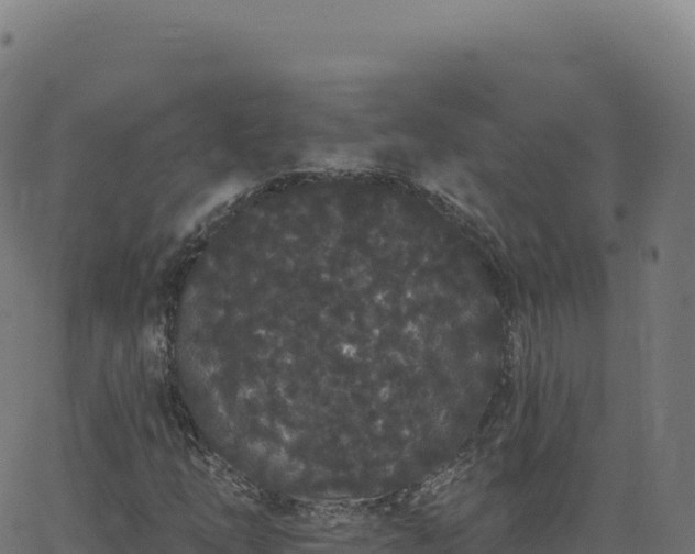 X0000062861254200601201720