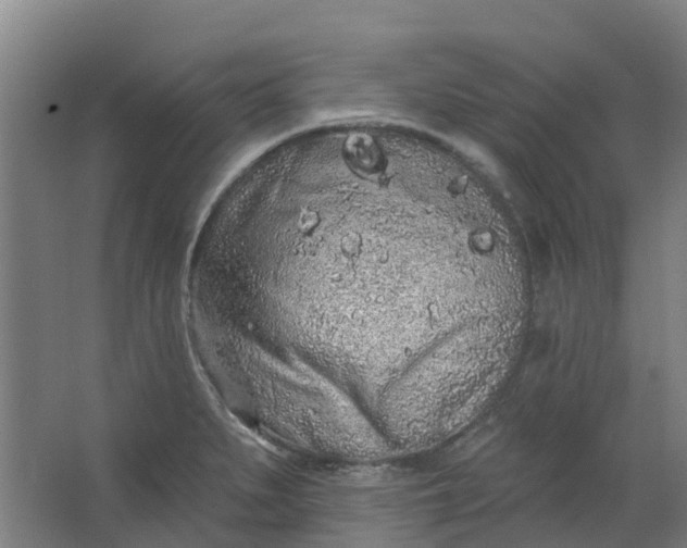 X0000062861279200601271520