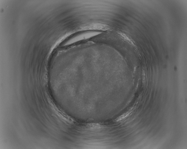 X0000062860392200602101632