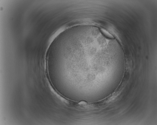 X0000062871095200601171415