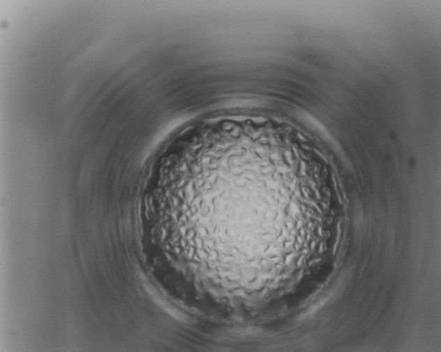 X0000062931417200601202015