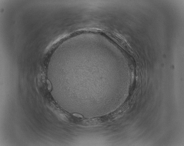 X0000063461159200601201238