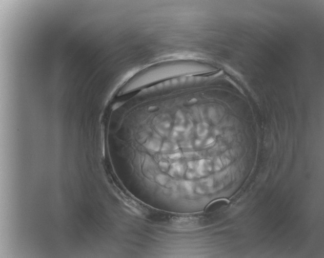 X0000063471171200602031852