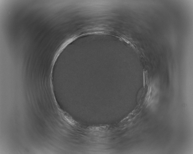 X0000063500147200601201421