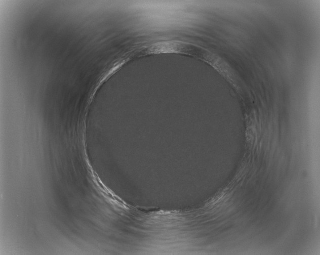 X0000063500386200601201418