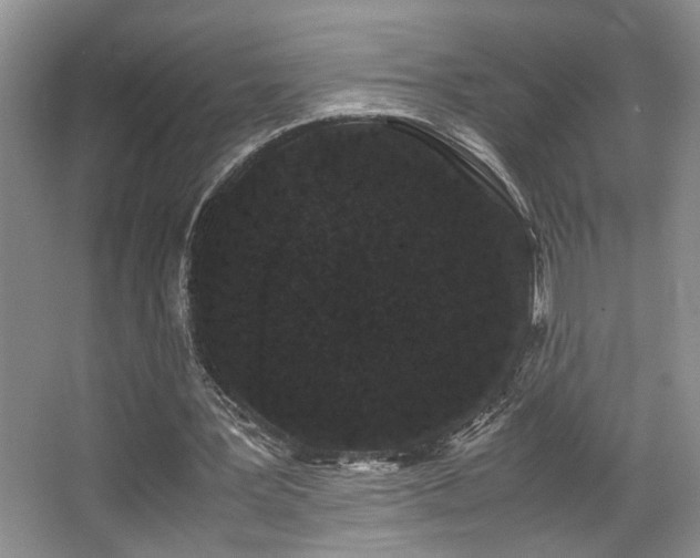 X0000063500387200601201418