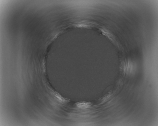 X0000063500465200601201417