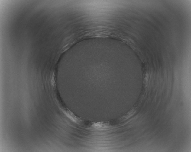X0000063500568200601201416