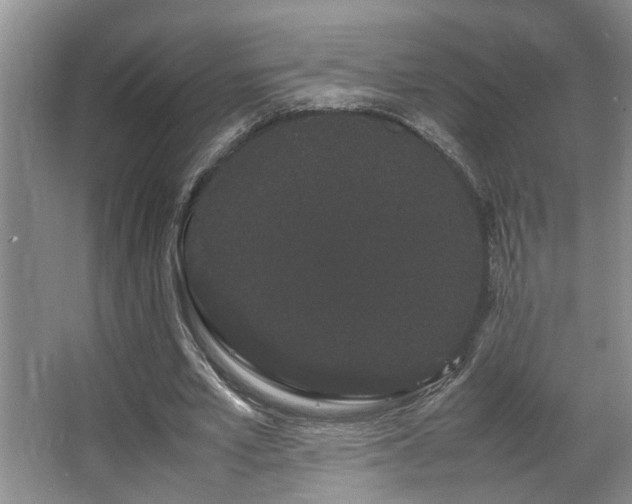 X0000063500581200601201415