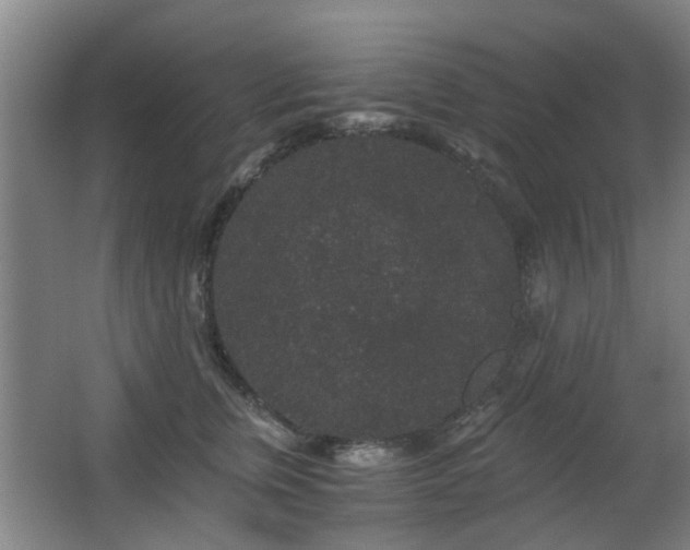 X0000063500759200601201412