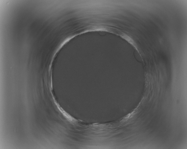 X0000063501127200601201405