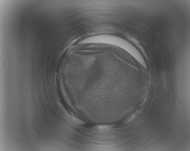 X0000063500154200602032026