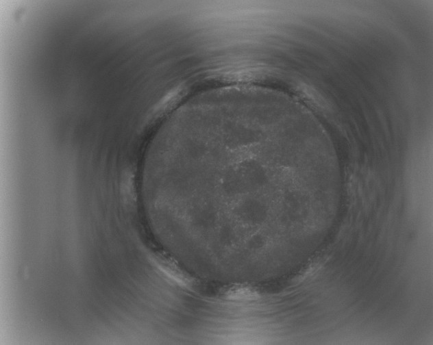 X0000063500258200602032025