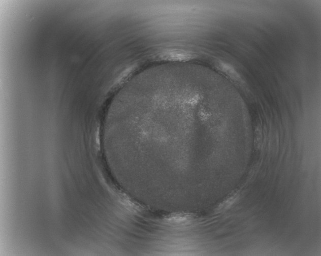 X0000063500358200602032023