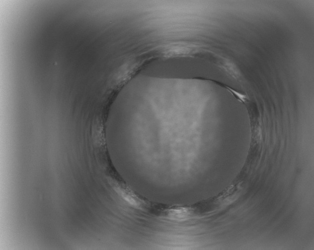 X0000063500411200602032022