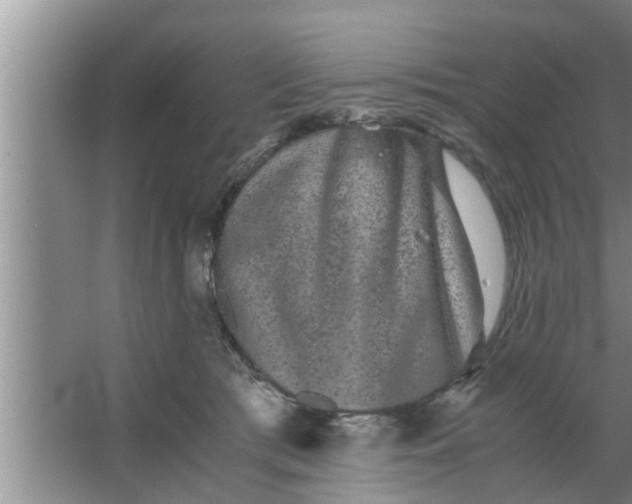 X0000063500417200602032022