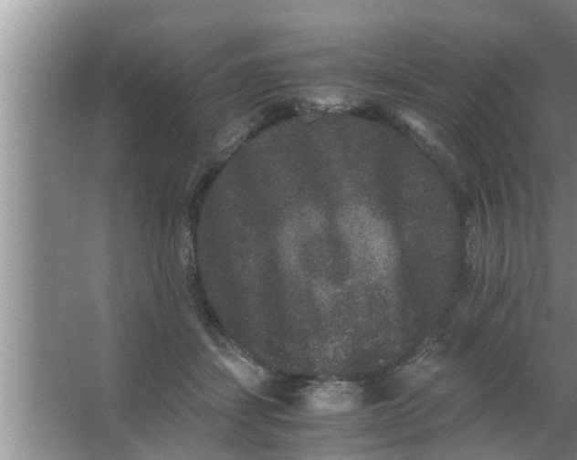 X0000063500459200602032022