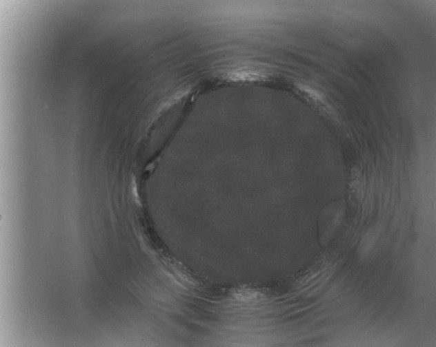 X0000063500547200602032020