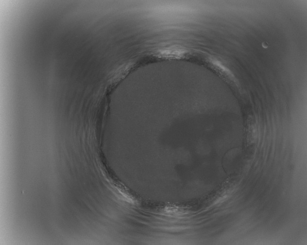 X0000063500641200602032018