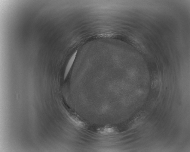 X0000063500647200602032018