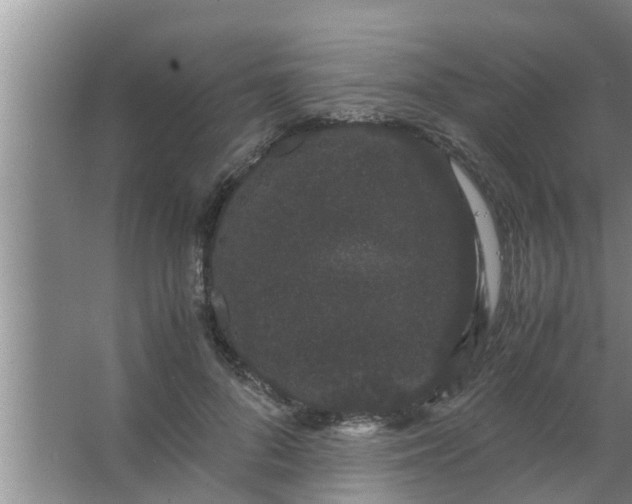 X0000063500696200602032018