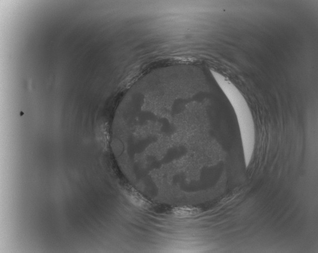 X0000063500707200602032017