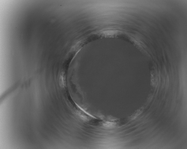 X0000063500718200602032017