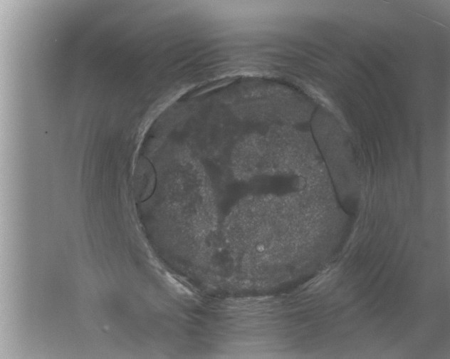 X0000063500721200602032016