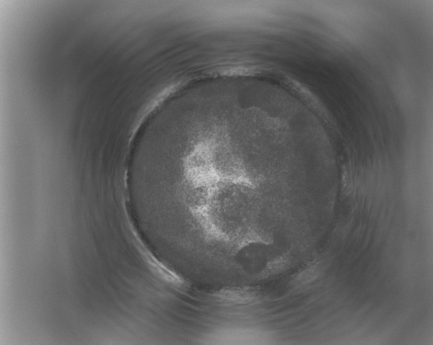 X0000063500725200602032017