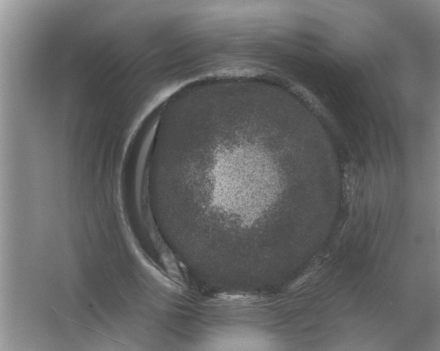 X0000063500726200602032017