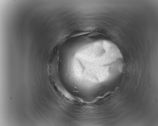 X0000063500743200602032017