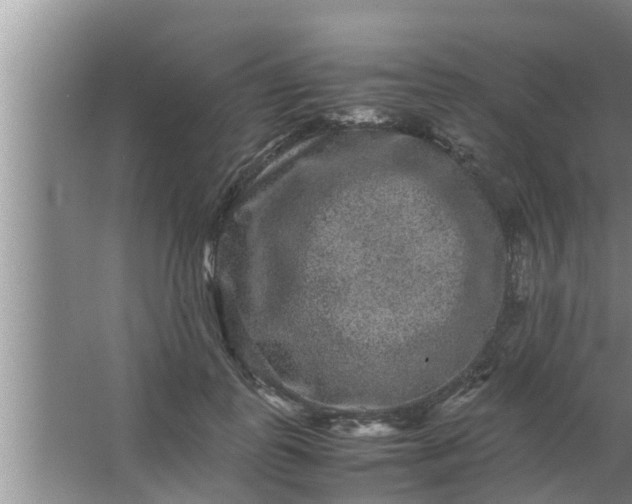 X0000063500747200602032017