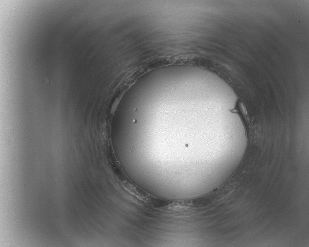 X0000063500756200602032017