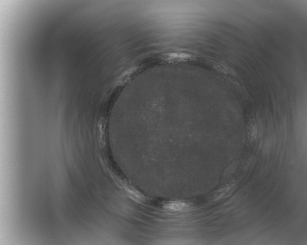 X0000063500759200602032017