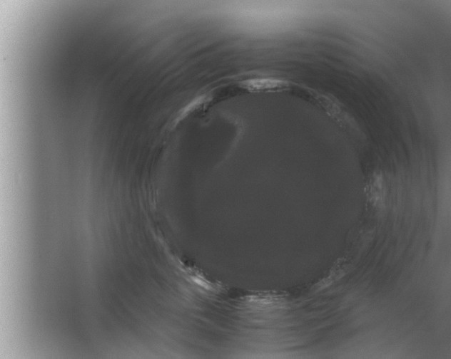 X0000063500763200602032017