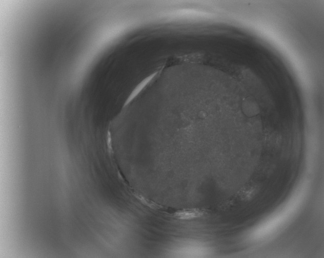 X0000063500765200602032017