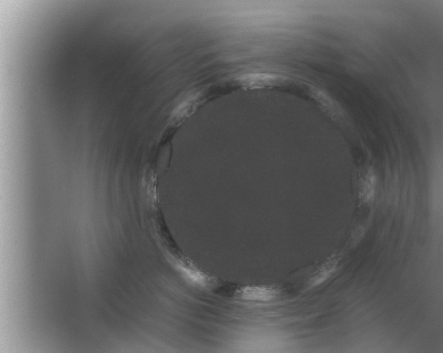 X0000063500766200602032017