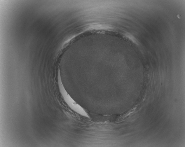 X0000063500775200602032016