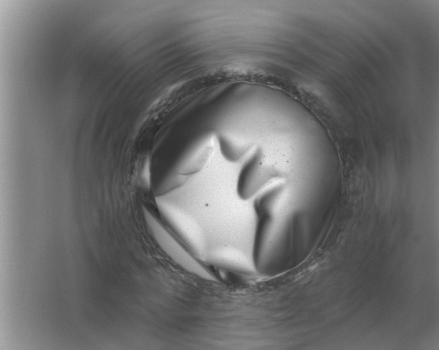 X0000063500776200602032016