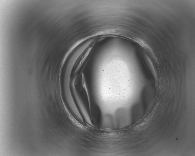 X0000063500792200602032016