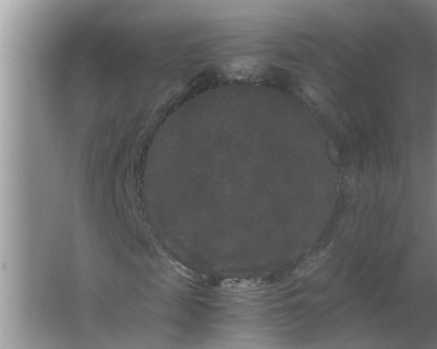 X0000063500817200602032015