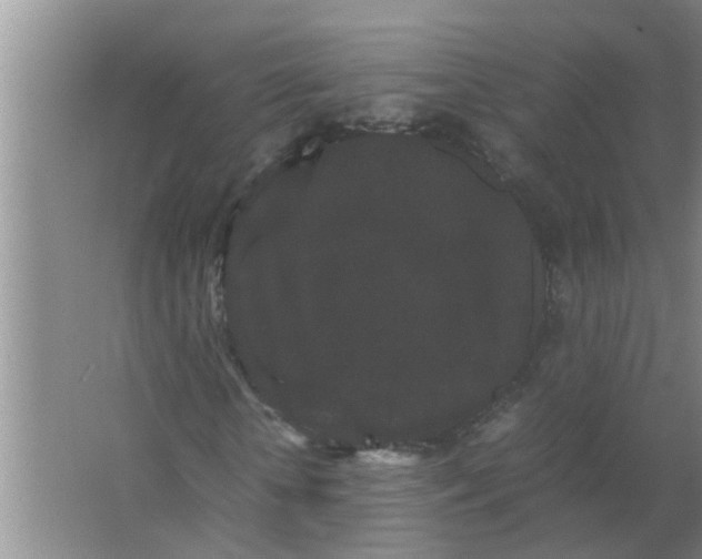 X0000063500818200602032015