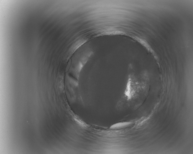 X0000063500889200602032014