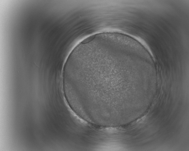 X0000063500911200602032014