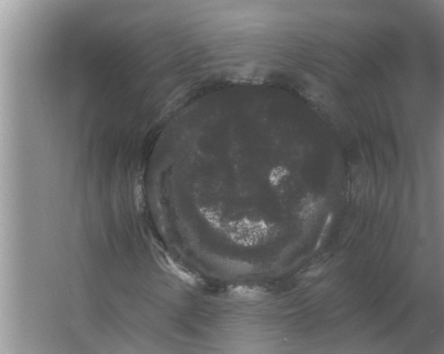 X0000063501154200602032010