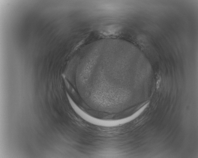 X0000063501156200602032010